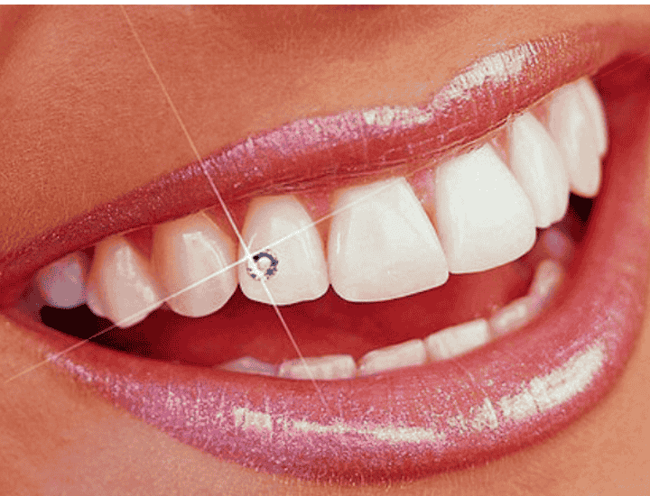 the dental studio tooth jewellery