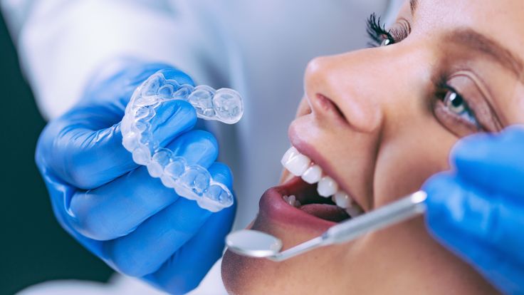 Orthodontic Treatment in Kothrud
