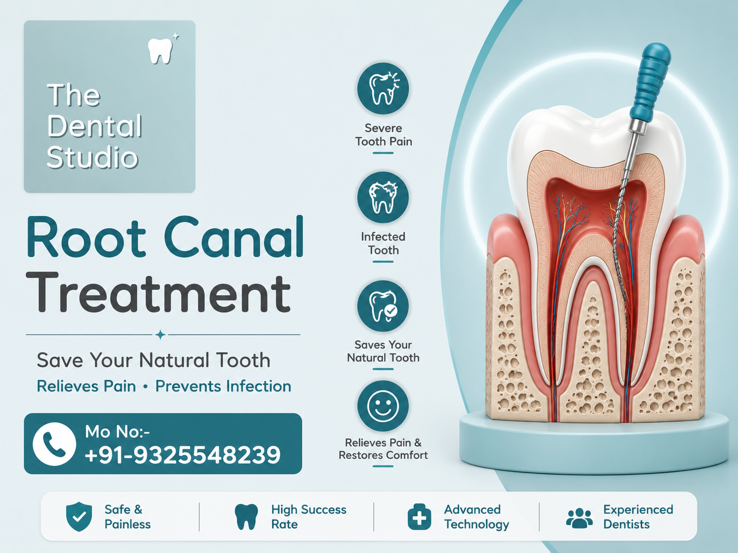 Root canal treatment in Kothrud Pune